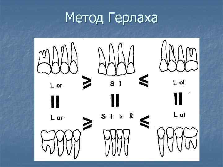 Метод Герлаха 