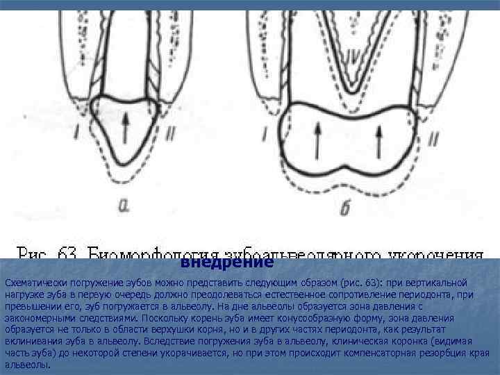 внедрение Схематически погружение зубов можно представить следующим образом (рис. 63): при вертикальной нагрузке зуба