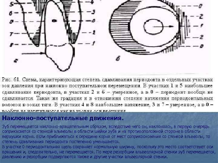 Наклонно-поступательные движения. Зуб перемещается наклонно-вращательным образом, вследствие чего он, наклоняясь, в первую очередь соприкасается