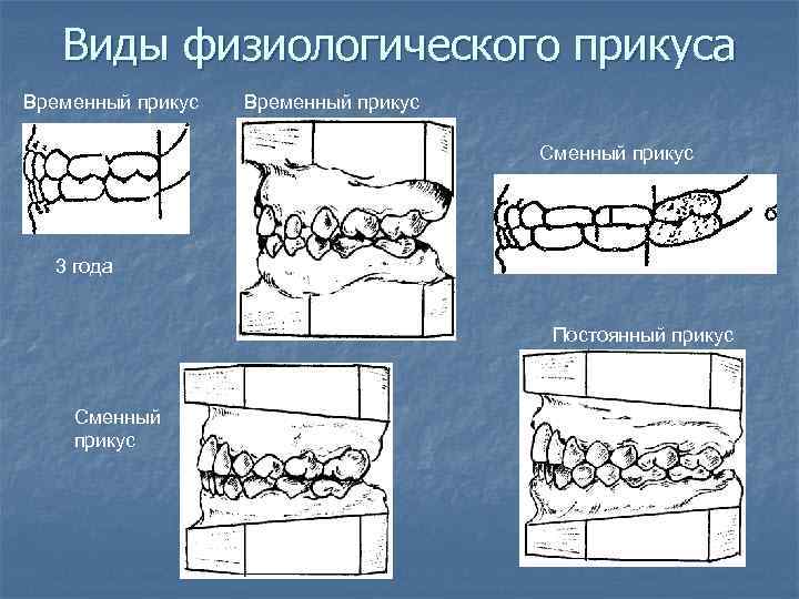 Виды физиологического прикуса Временный прикус Сменный прикус 3 года Постоянный прикус Сменный прикус 