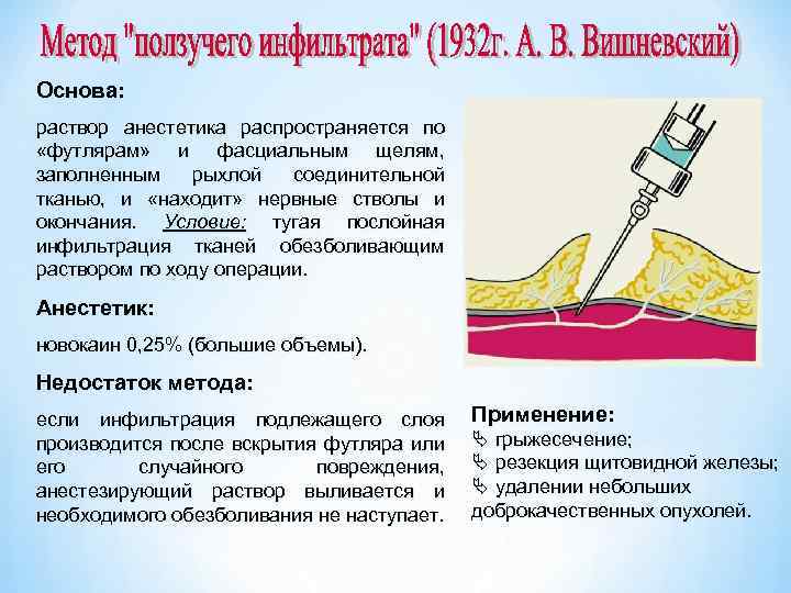 Основа: раствор анестетика распространяется по «футлярам» и фасциальным щелям, заполненным рыхлой соединительной тканью, и