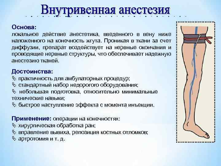 Основа: локальное действие анестетика, введенного в вену ниже наложенного на конечность жгута. Проникая в