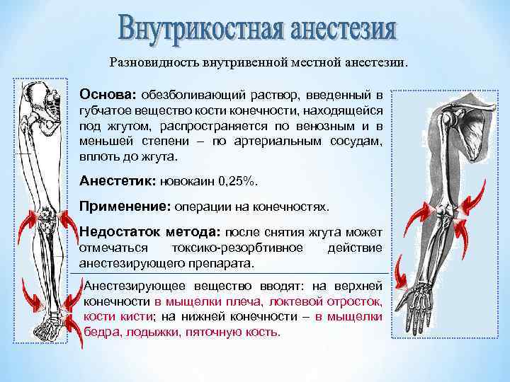 Разновидность внутривенной местной анестезии. Основа: обезболивающий раствор, введенный в губчатое вещество кости конечности, находящейся