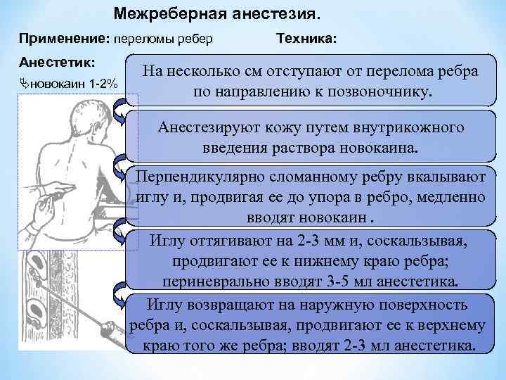 Межреберная анестезия. Применение: переломы ребер Анестетик: новокаин 1 -2% Техника: На несколько см отступают