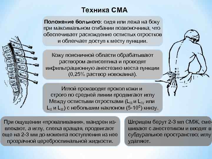 Техника СМА Положение больного: сидя или лежа на боку при максимальном сгибании позвоночника, что