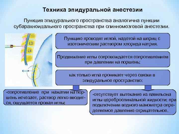 Техника эпидуральной анестезии Пункция эпидурального пространства аналогична пункции субарахноидального пространства при спинномозговой анестезии. Пункцию