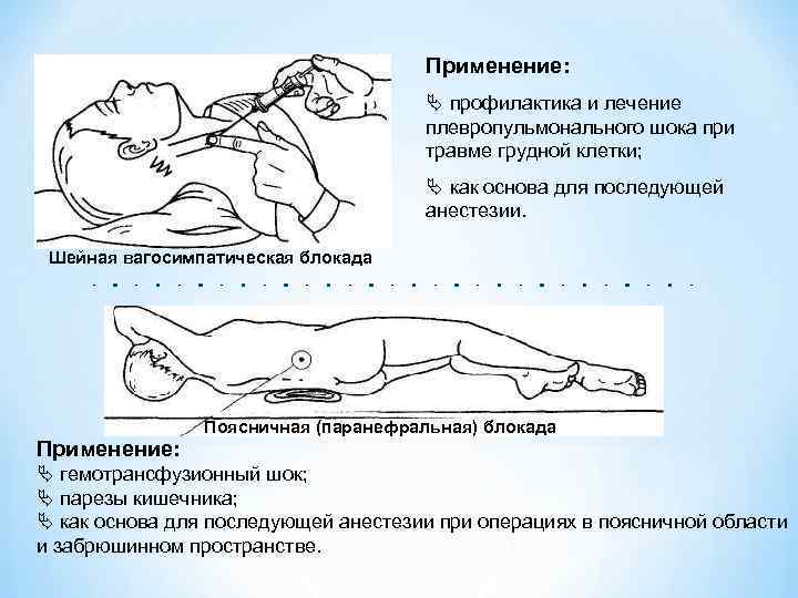 Применение: профилактика и лечение плевропульмонального шока при травме грудной клетки; как основа для последующей