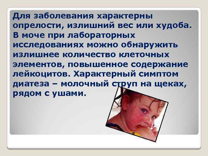 Для заболевания характерны опрелости, излишний вес или худоба. В моче при лабораторных исследованиях можно