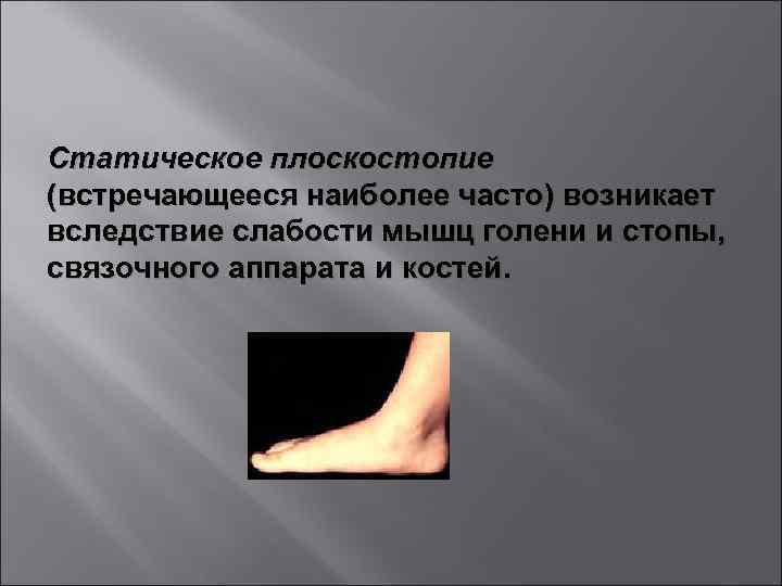 Статическое плоскостопие (встречающееся наиболее часто) возникает вследствие слабости мышц голени и стопы, связочного аппарата