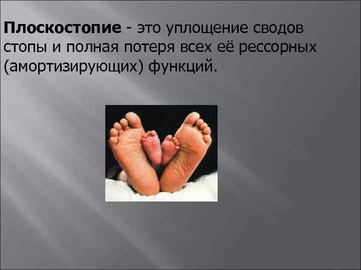 Плоскостопие - это уплощение сводов стопы и полная потеря всех её рессорных (амортизирующих) функций.