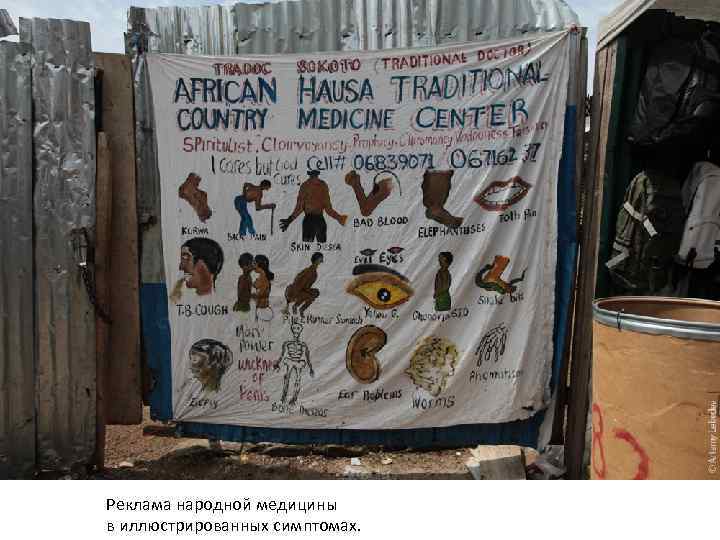 Реклама народной медицины в иллюстрированных симптомах. 