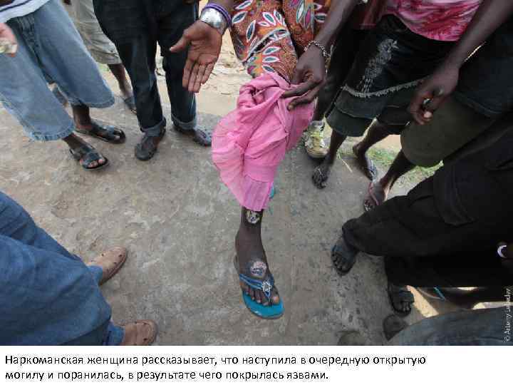 Наркоманская женщина рассказывает, что наступила в очередную открытую могилу и поранилась, в результате чего