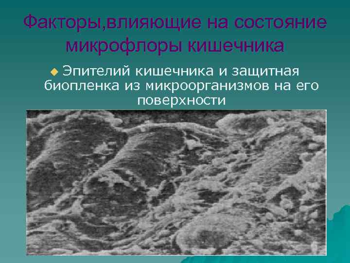 Факторы, влияющие на состояние микрофлоры кишечника Эпителий кишечника и защитная биопленка из микроорганизмов на