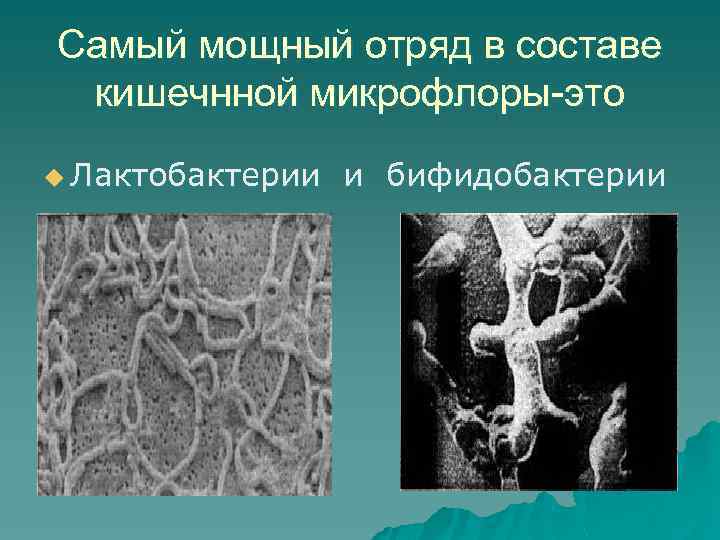Самый мощный отряд в составе кишечнной микрофлоры-это u Лактобактерии и бифидобактерии 