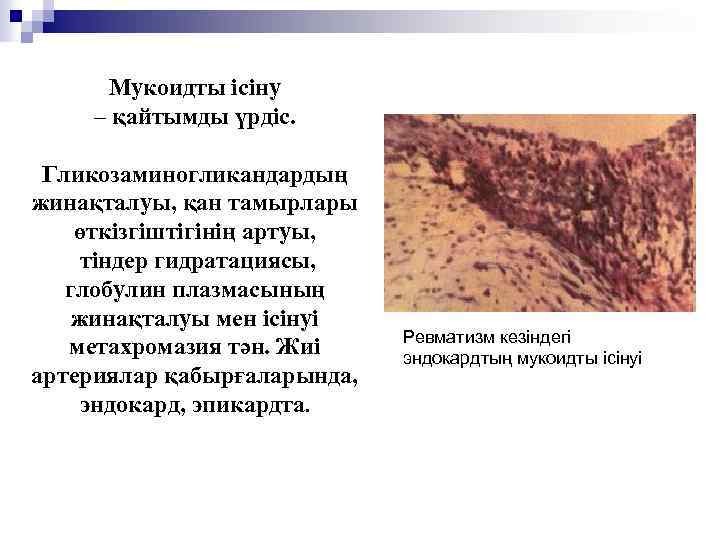 Мукоидты ісіну – қайтымды үрдіс. Гликозаминогликандардың жинақталуы, қан тамырлары өткізгіштігінің артуы, тіндер гидратациясы, глобулин