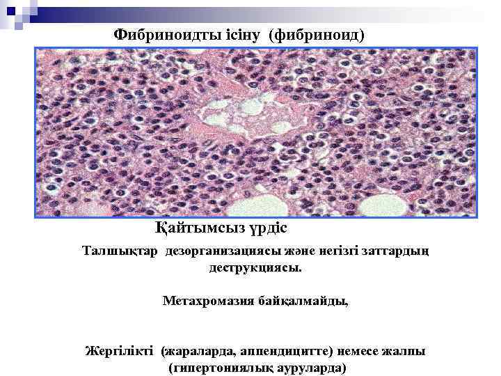 Фибриноидты ісіну (фибриноид) Қайтымсыз үрдіс Талшықтар дезорганизациясы және негізгі заттардың деструкциясы. Метахромазия байқалмайды, Жергілікті