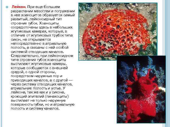  Лейкон. При еще большем разрастании мезоглеи и погружении в нее хоаноцитов образуется самый