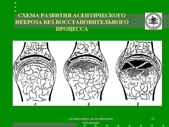 Псп в ортопедии что это