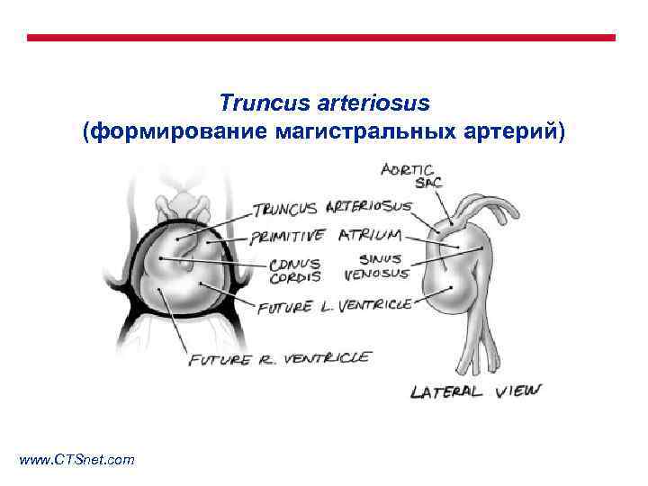 Truncus arteriosus (формирование магистральных артерий) www. CTSnet. com 