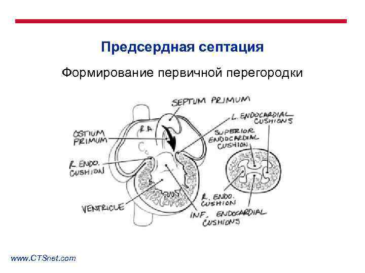 Предсердная септация Формирование первичной перегородки www. CTSnet. com 