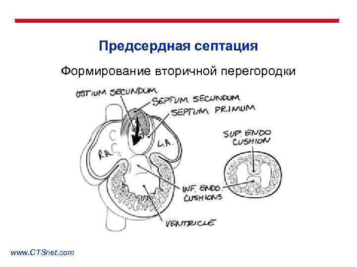 Предсердная септация Формирование вторичной перегородки www. CTSnet. com 