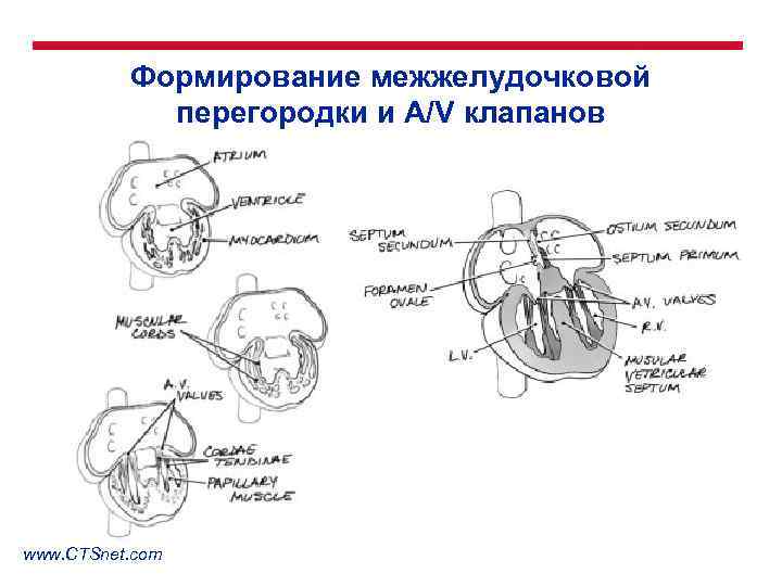 Формирование межжелудочковой перегородки и A/V клапанов www. CTSnet. com 