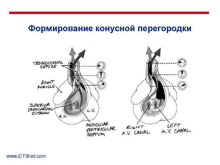 Формирование конусной перегородки www. CTSnet. com 