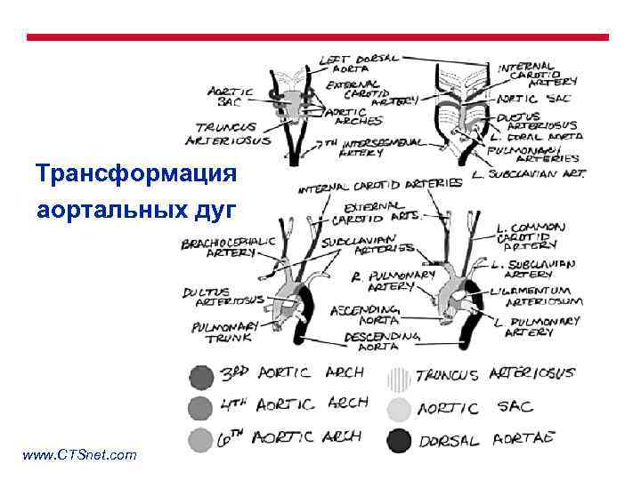 Трансформация аортальных дуг www. CTSnet. com 