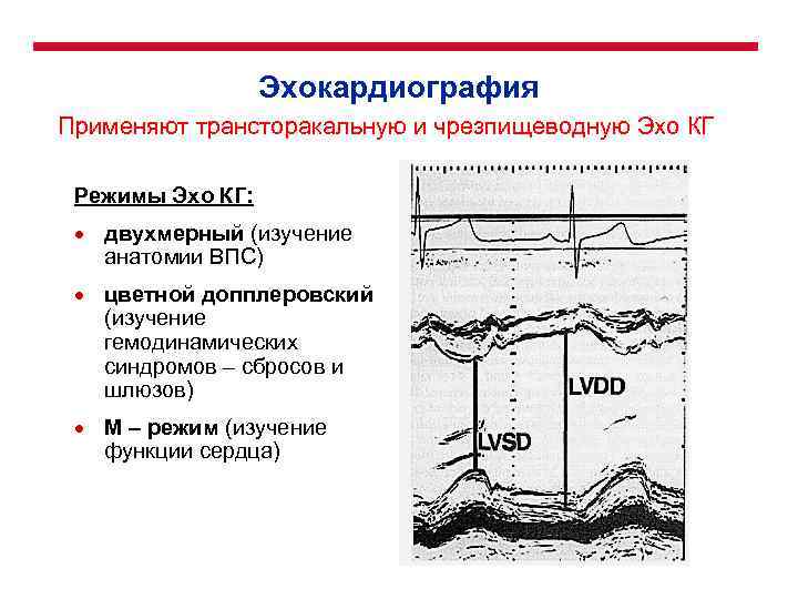 Эхокардиография Применяют трансторакальную и чрезпищеводную Эхо КГ Режимы Эхо КГ: · двухмерный (изучение анатомии