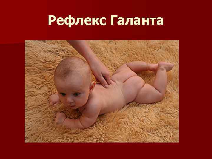 Рефлекс Галанта 