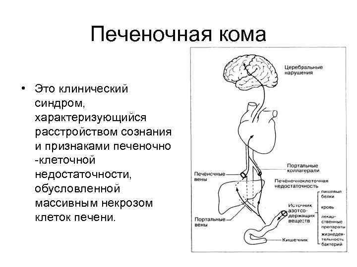 Печеночная кома • Это клинический синдром, характеризующийся расстройством сознания и признаками печеночно -клеточной недостаточности,