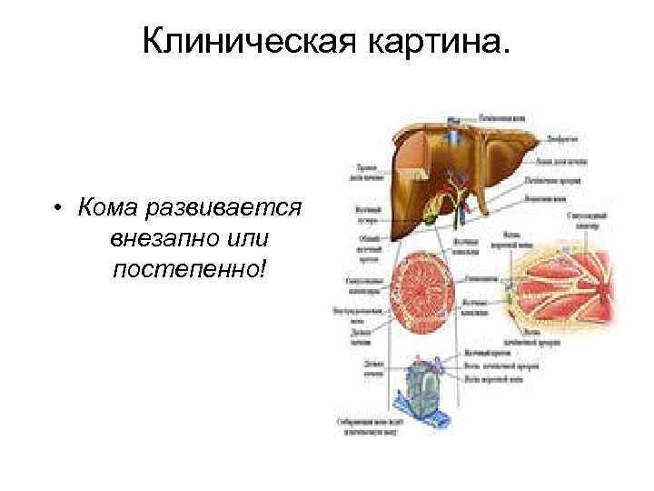Клиническая картина. • Кома развивается внезапно или постепенно! 