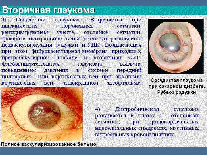 Презентация по офтальмологии