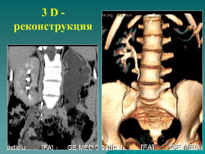 3 Dреконструкция 