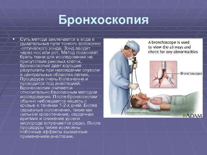Бронхоскопия § Суть метода заключается в воде в дыхательные пути тонкого волоконно -оптического зонда.