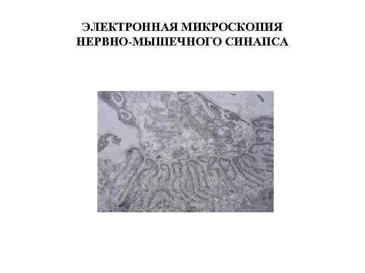 ЭЛЕКТРОННАЯ МИКРОСКОПИЯ НЕРВНО-МЫШЕЧНОГО СИНАПСА 