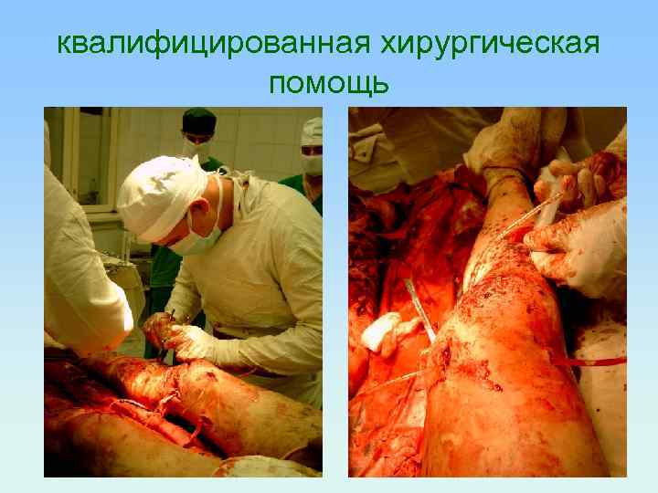 квалифицированная хирургическая помощь 