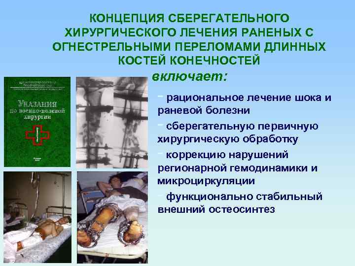 КОНЦЕПЦИЯ СБЕРЕГАТЕЛЬНОГО ХИРУРГИЧЕСКОГО ЛЕЧЕНИЯ РАНЕНЫХ С ОГНЕСТРЕЛЬНЫМИ ПЕРЕЛОМАМИ ДЛИННЫХ КОСТЕЙ КОНЕЧНОСТЕЙ включает: - рациональное