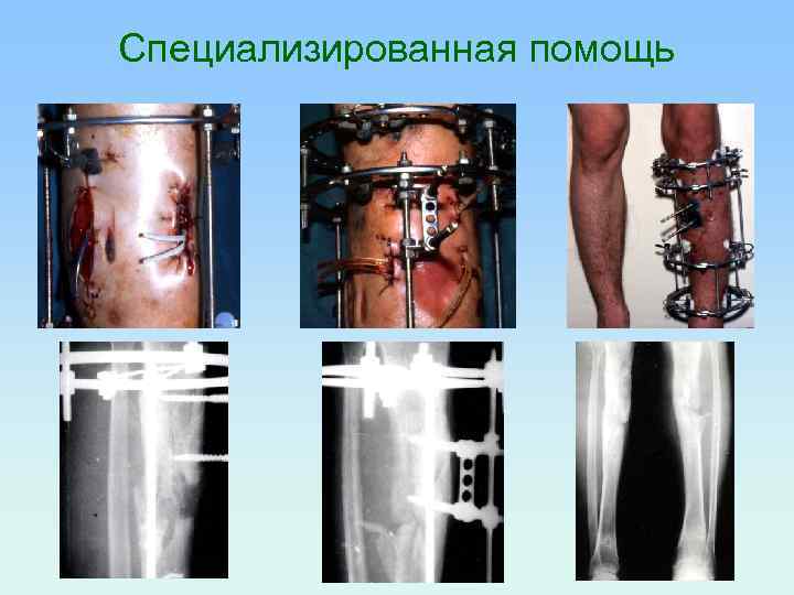 Специализированная помощь 