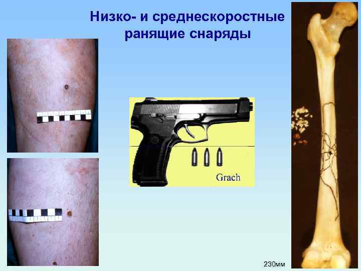 Низко- и среднескоростные ранящие снаряды 230 мм 