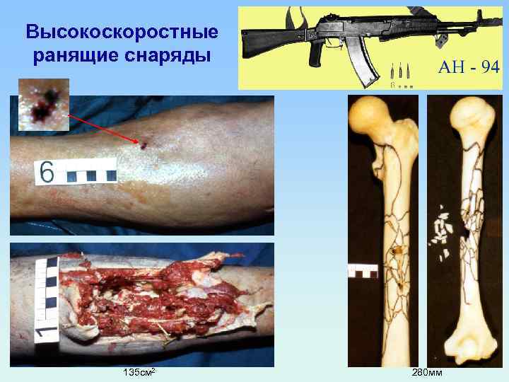 Высокоскоростные ранящие снаряды 135 см 2 280 мм 