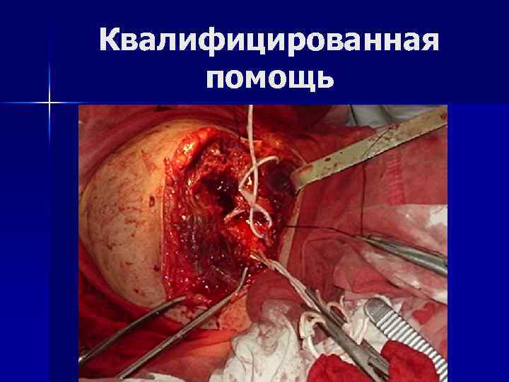 Квалифицированная помощь 