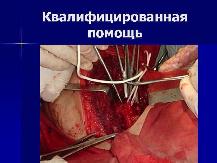 Квалифицированная помощь 