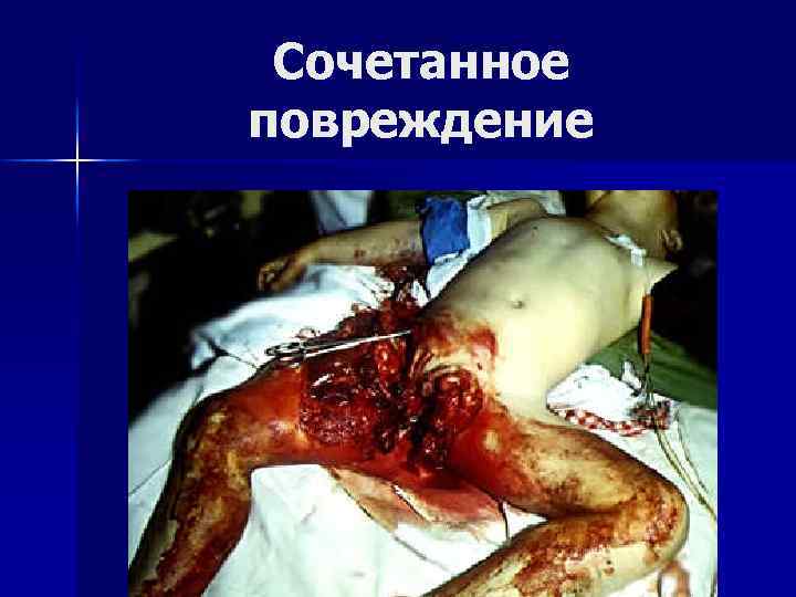 Сочетанное повреждение 