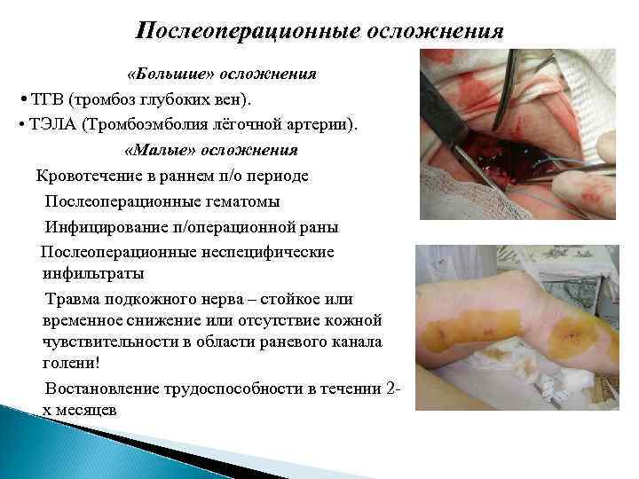 Послеоперационные осложнения «Большие» осложнения • ТГВ (тромбоз глубоких вен). • ТЭЛА (Тромбоэмболия лёгочной артерии).