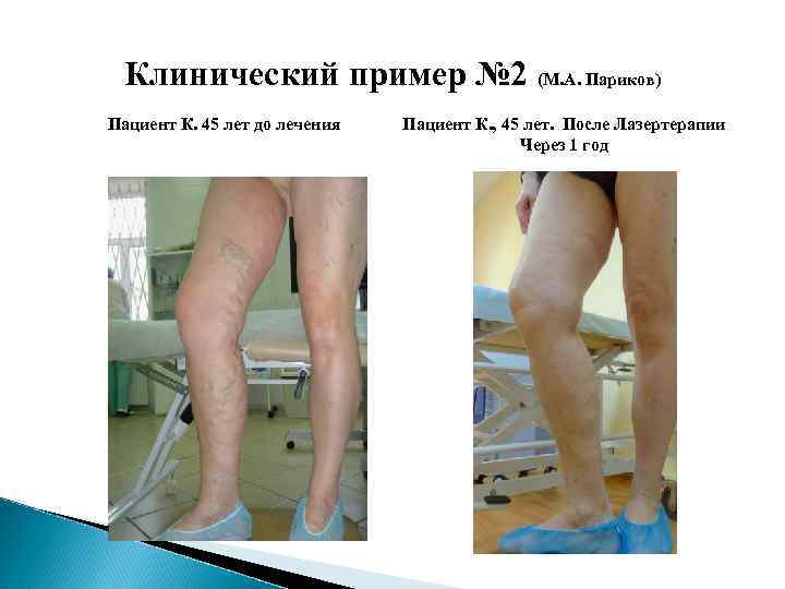 Клинический пример № 2 (М. А. Париков) Пациент К. 45 лет до лечения Пациент