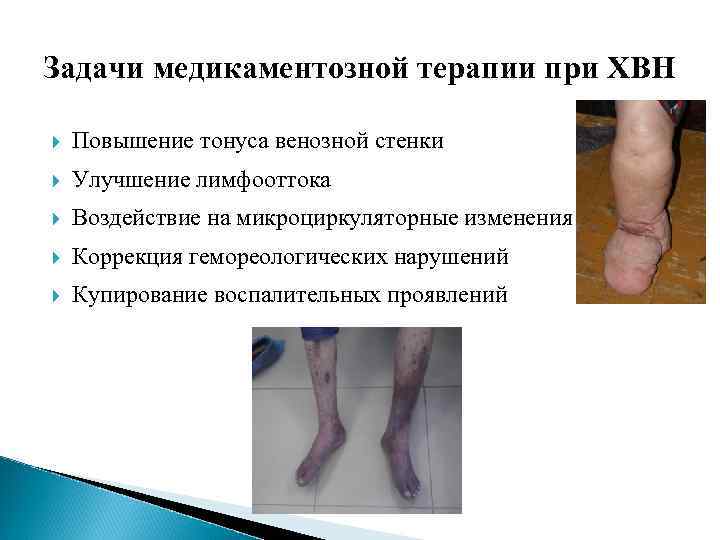 Задачи медикаментозной терапии при ХВН Повышение тонуса венозной стенки Улучшение лимфооттока Воздействие на микроциркуляторные