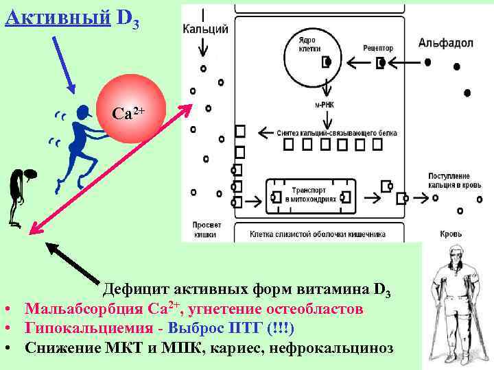 Активный D 3 Са 2+ Дефицит активных форм витамина D 3 • Мальабсорбция Са