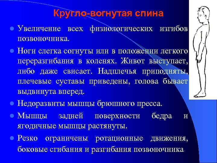  Кругло-вогнутая спина l Увеличение всех физиологических изгибов позвоночника. l Ноги слегка согнуты или