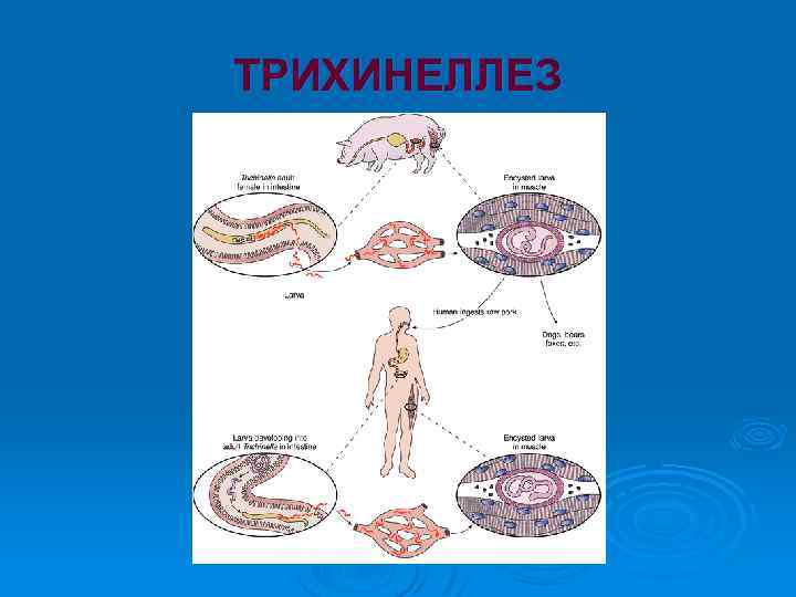 ТРИХИНЕЛЛЕЗ 